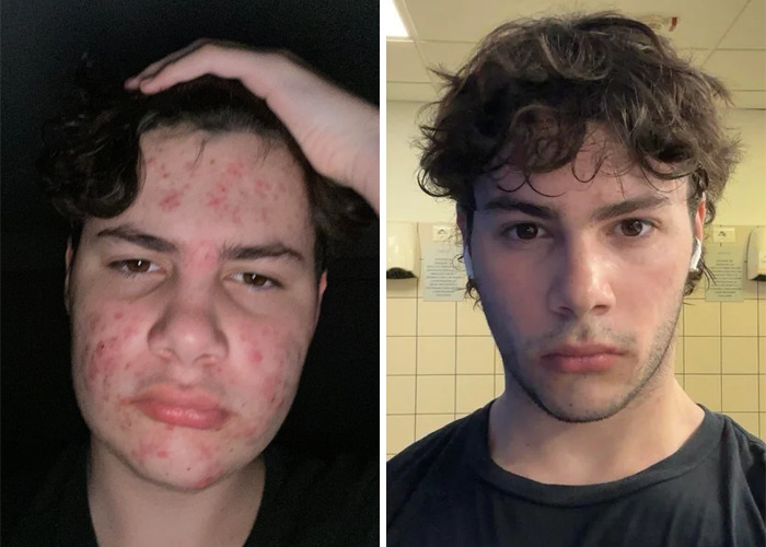 Sample before and after facial transformation result